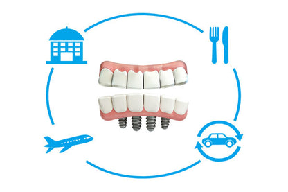 Full Mouth All-On-4 Implants Package(1 Jaw)